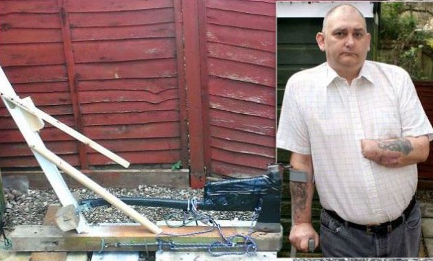 12. Człowiek, który zbudował gilotynę i odciął sobie rękę, ukracając 16 lat męki po tym jak lekarze odmówili mu amputacji.