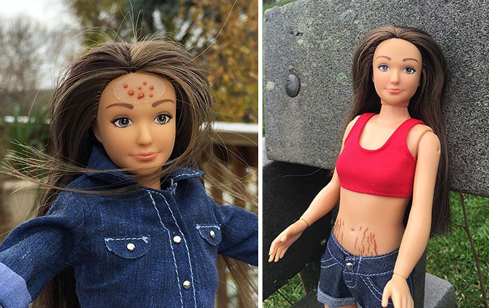 „Normalna Barbie” ma ciało o proporcjach przeciętnej 19-letniej dziewczyny z trądzikiem, cellulitem i rozstępami.