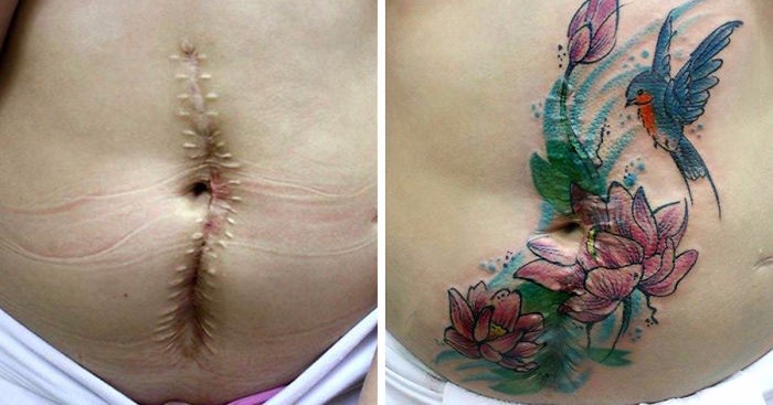 Artystka wykonuje darmowe tatuaże okaleczonym ofiarom przemocy domowej.