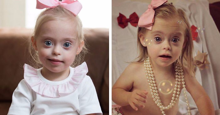 2-latka z zespołem Downa zostaje modelką dzięki swojemu niepowtarzalnemu uśmiechowi.