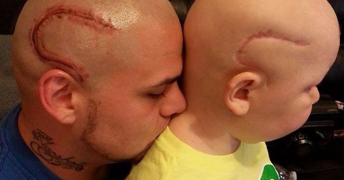 Kochający ojciec wytatuował sobie na głowie bliznę, by dodać odwagi swojemu synowi.