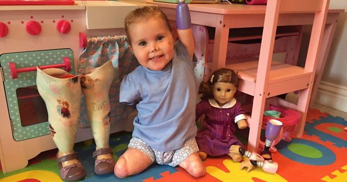 2-letnia dziewczynka o amputowanych kończynach otrzymała od rodziców lalkę-bliźniaczkę.
