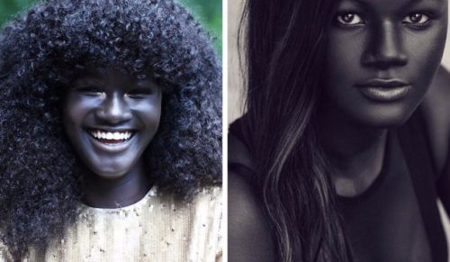 Nastolatka dręczona ze względu na nieprzeciętnie ciemny kolor skóry została światowej sławy modelką.