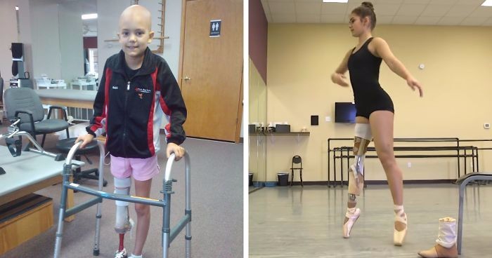 Straciła nogę z powodu nowotworu. Mimo to zdołała spełnić swoje największe marzenie.