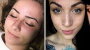 Tatuowane piegi – trend, który oczarował użytkowników Instagrama. Robią to nawet mężczyźni!