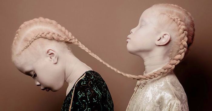 Bliźniacze albinoski z Brazylii zachwyciły świat mody udziałem w profesjonalnej sesji zdjęciowej.