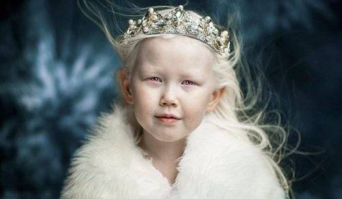 8-letnia Królewna Śnieżka z Syberii zachwyciła świat swoim unikatowym pięknem.