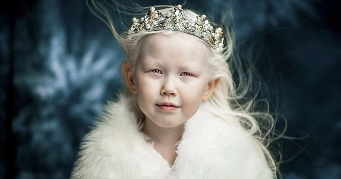 8-letnia Królewna Śnieżka z Syberii zachwyciła świat swoim unikatowym pięknem.