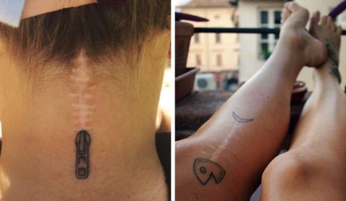15 niesamowitych tatuaży, które przemieniły blizny w małe dzieła sztuki.