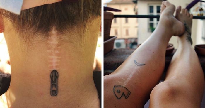 15 niesamowitych tatuaży, które przemieniły blizny w małe dzieła sztuki.