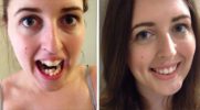 10 niewiarygodnych przemian, jakich doświadczyli ludzie, którzy zdecydowali się na aparat ortodontyczny.