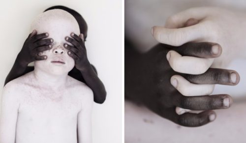 Zdumiewające piękno dzieci dotkniętych albinizmem w obiektywie nagradzanej holenderskiej artystki.