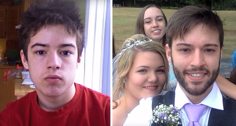 Ten chłopak robił sobie zdjęcia od 12. roku życia – uśmiechnął się dopiero w dniu swojego ślubu!