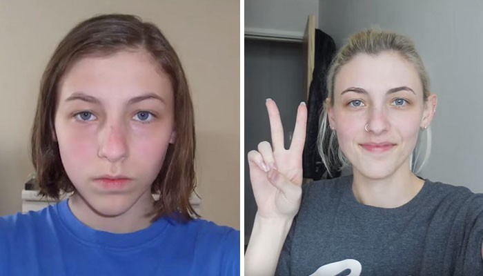 Nastolatka robiła sobie selfie codziennie przez 8 lat, zobacz w jak subtelny sposób się zmieniała!