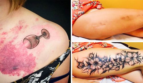21 tatuaży, które zmieniają wady skóry w arcydzieła!