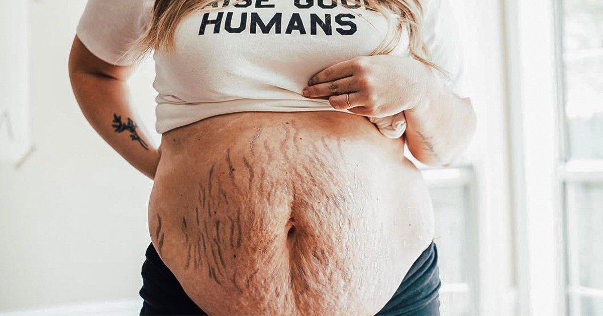 20 kobiet, które pokazały swoje ciała po ciąży i jesteśmy z nich dumni!