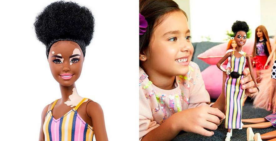 Barbie świętuje różnorodność, tworząc lalki niepełnosprawne, z bielactwem i bez włosów, w 35 różnych odcieniach skóry!