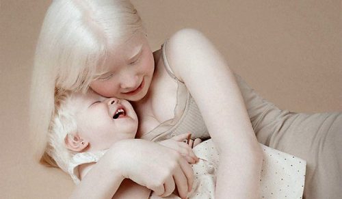 Siostry albinoski urodziły się w odstępstwie 12 lat od siebie i oszałamiają świat swoją niezwykłą urodą!