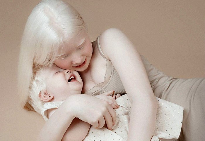 Siostry albinoski urodziły się w odstępstwie 12 lat od siebie i oszałamiają świat swoją niezwykłą urodą!