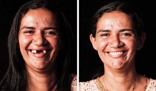Brazylijski dentysta podróżuje po świecie, aby bezpłatnie przywrócić uśmiechy na twarzach biednych ludzi!