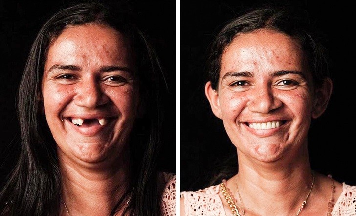 Brazylijski dentysta podróżuje po świecie, aby bezpłatnie przywrócić uśmiechy na twarzach biednych ludzi!