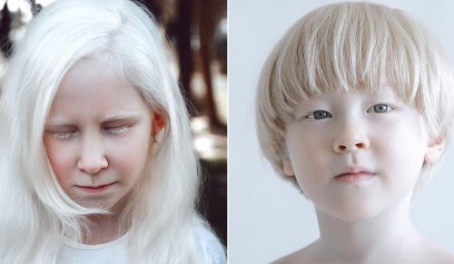 Fotografka fotografuje ludzi z albinizmem, aby pokazać ich oszałamiające i niepowtarzalne piękno!