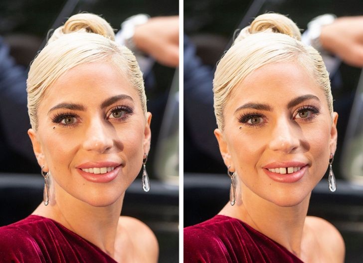 15 zdjęć, które pokazują, jak zęby mogą zmienić twarz!