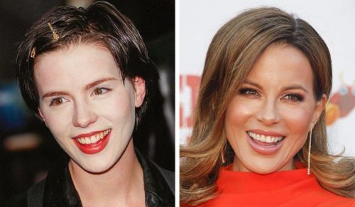13 zdjęć celebrytek „przed i po”, które dowodzą, że kobiety kwitną wraz z wiekiem!