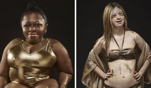 Fotografowie zrobili sesję 18 niepełnosprawnych kobiet, aby uczcić ich wyjątkowość!