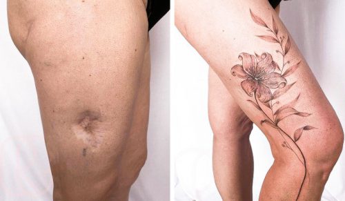 Artystka tatuuje blizny, aby ludzie mogli pokazać to, co dotychczas chcieli ukrywać!
