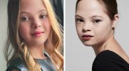 Dziewczynka z zespołem Downa została porzucona po urodzeniu, teraz została gwiazdą Hollywood!