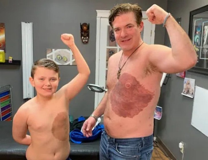 Tata przeżył 30 godzin bólu podczas tatuowania, aby jego syn mógł poczuć się lepiej ze swoim znamieniem!