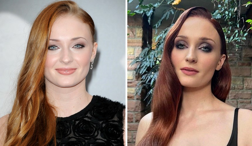 W obliczu dramatu rozwodowego ludzie zastanawiają się czy Sophie Turner zrobiła coś ze swoją twarzą!