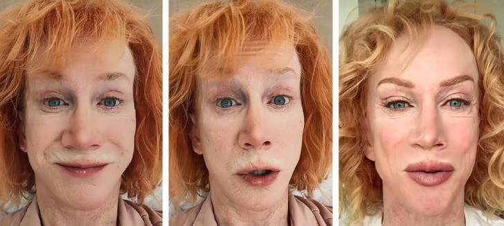 Kathy Griffin szokuje fanów pokazując efekt tatuażu na ustach!