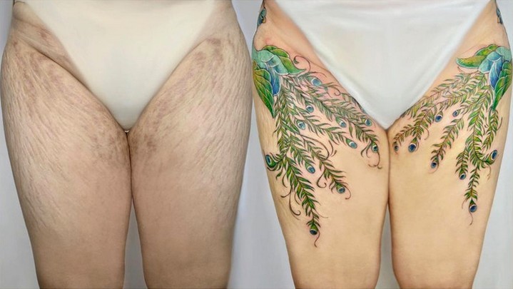 15 osób, które dzięki wietnamskiej artystce zamieniły swoje blizny w piękne tatuaże!