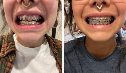 12 osób, które zmieniły swoje życie, dbając o zęby!