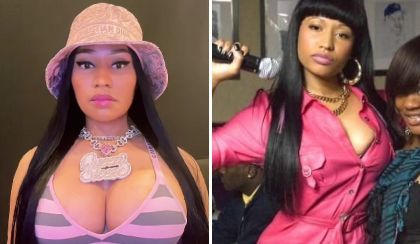 Nicki Minaj żałuje, że przeszła operacje plastyczne po obejrzeniu swoich najstarszych zdjęć!