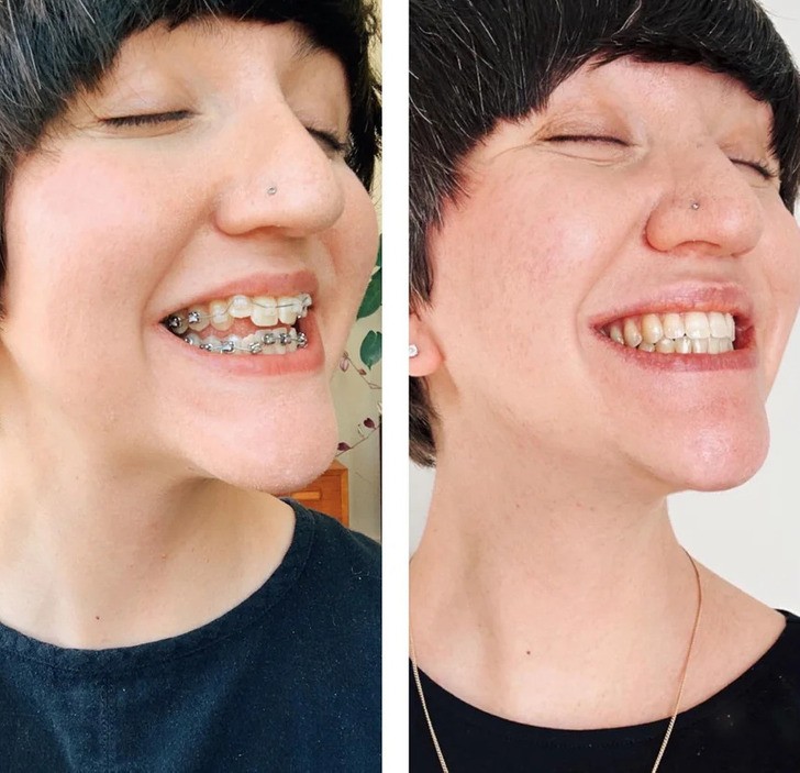 12 osób, których życie zmieniło się dzięki właściwej dbałości o zęby!