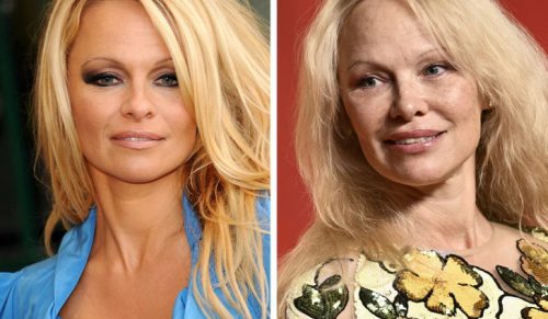 Pamela Anderson olśniewa na Oscarach bez makijażu i wywołuje debatę!