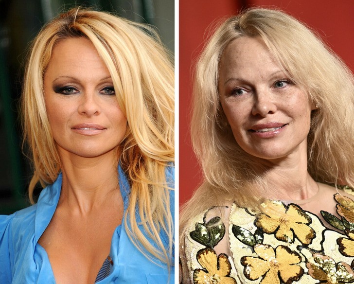 Pamela Anderson olśniewa na Oscarach bez makijażu i wywołuje debatę!