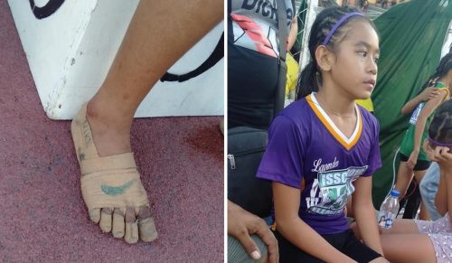 Dziewczynka zdobyła 3 złote medale bez butów, a viralowe zdjęcie zmieniło jej życie!