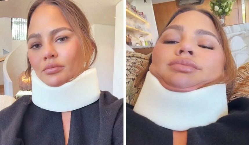 Chrissy Teigen ujawnia potworną kontuzję, podczas gdy przegapiła Met Galę 2024!