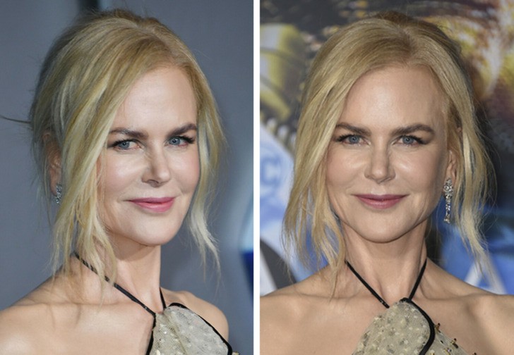 Wygląd Nicole Kidman na Met Gali budzi niepokój!