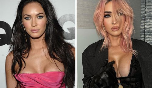 26 gwiazd przed i po operacjach plastycznych, w tym Kim Kardashian i Ariana Grande!