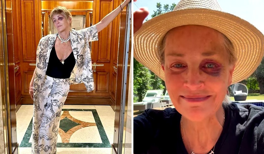 Sharon Stone udostępniła zdjęcie z jednym podbitym okiem i zaniepokoiła fanów!