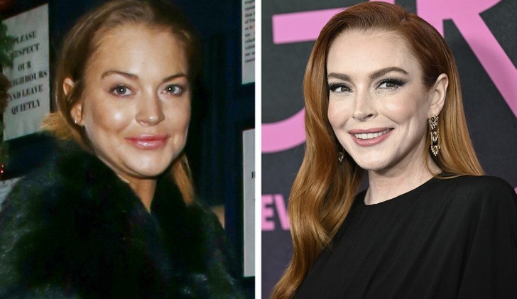 „Rozpuściła każdą kroplę wypełniacza” – najnowsze zdjęcia Lindsay Lohan wywołują poruszenie!