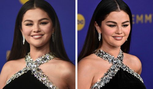 „Co ona zrobiła swojej twarzy?” – Selena Gomez wywołuje gorące emocje po niedawnym występie!