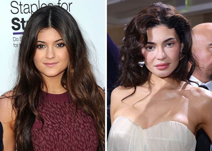 Pójście pod nóż miało brutalne skutki dla tych 23 celebrytów!