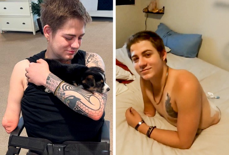 Mężczyzna przecięty na pół przez wózek widłowy przełamuje wszelkie granice, by żyć i inspirować miliony!