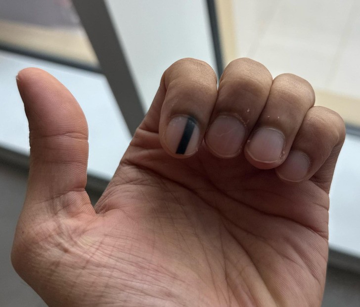 15 tajemniczych rzeczy, które przydarzyły się prawdziwym ciałom ludzi!